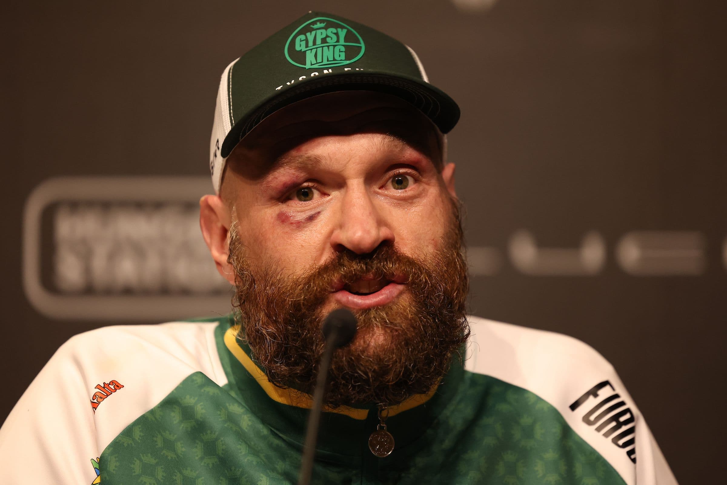 Tyson Fury On Second Loss To Oleksandr Usyk: In My Opinion, A Christmas Gift To Him